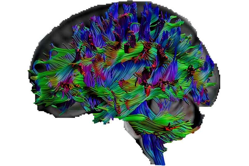 Diffusion tensor imaging, a type of magnetic resonance imaging, allowed researchers at Ruhr-Universität Bochum and Humboldt-Universität zu Berlin to vizualize the pathways of nerve fibers in various human subjects. Credit: Erhan Genç.